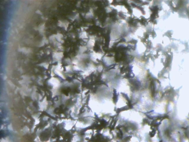 Колонии грибов под микроскопом